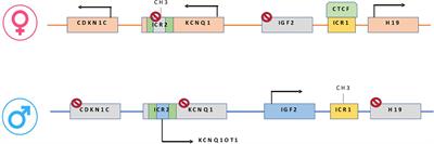 Preclinical and Clinical Epigenetic-Based Reconsideration of Beckwith-Wiedemann Syndrome